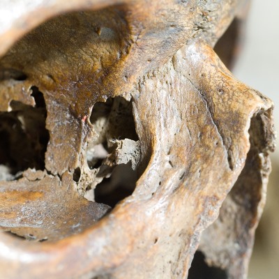 CD Forensic Anthropology