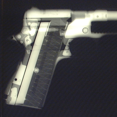 Radiographic Investigations